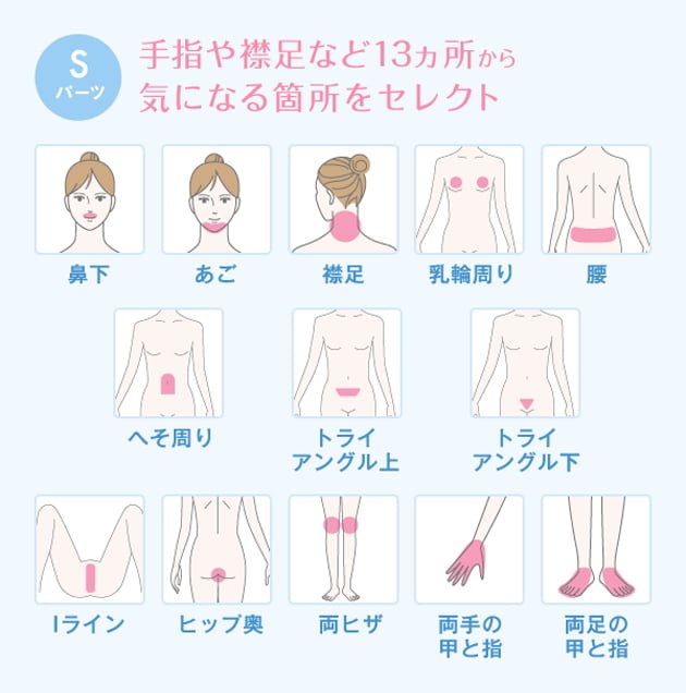 値段はいくら ミュゼのフリーセレクト脱毛プラン 6回8回12回 料金 つるっと全身脱毛